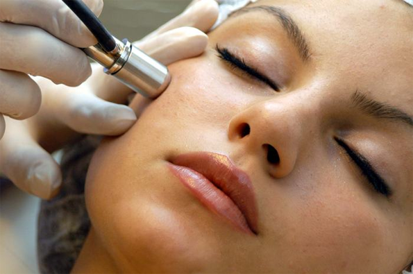 Medical Microdermabrasion